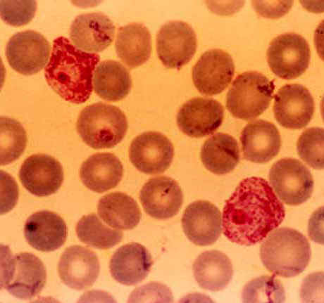 Glóbulos rojos y Plasmodium falciparum