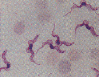 El protozzo Trypanosoma gambiense es un parásito que transmite la enfermedad del sueño