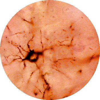 Imagen de una oligodendroglía