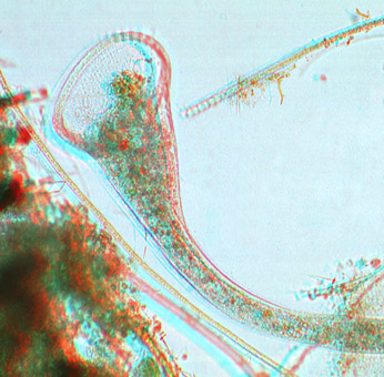 Stentor es un protozoo ciliado
