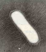 Bacteria, Escherichia coli, del Reino Moneras