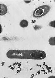 Clostridium, bacteria anaerobia.
