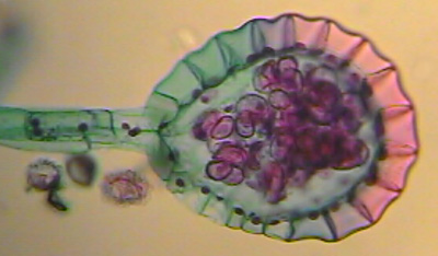 "Esporangio de un helecho, lugar donde se forman las esporas. Tomada de www.biology.iastate.edu "