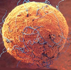 " Óvulo rodeado de espermatozoides; uno de ellos penetrará en su interior dándose la fecundación. Tomada de www.tudoporumbebe.hpg.ig.com.br"