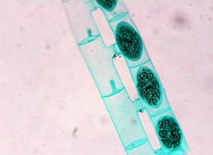 Algas filamentosas que se acaban de reproducir uniendo sus núcleos a través de un tubo. Tomada de micol.fcien.edu.uy"