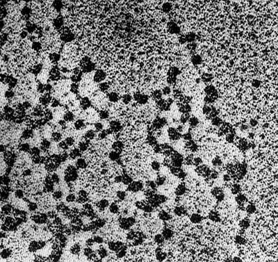 Nucleosomas vistos al microscopio electrónico, formando un "collar de perlas".