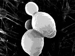 Saccharomyces cerevisiae vista al microscopio electrnico. Imagen tomada de http://www.engormix.com/microscopia.jpg