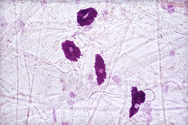 Mastocitos en tejido conjuntivo laxo