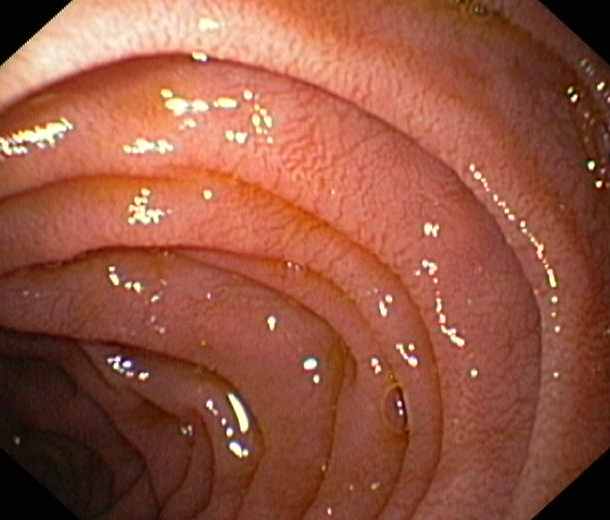 Mucosa gástrica