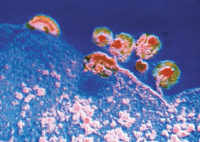 Virus de SIDA y clulas infectadas