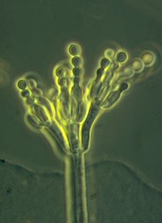 El hongo Penicillium es un Deuteromicete