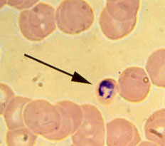 Plasmodium dentro de un glbulo rojo