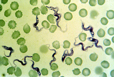 Trypanosomas en sangre