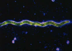 Treponema pallidum, bacteria de la Sfilis