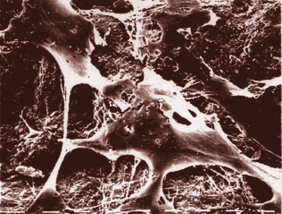 Células óseas en huecos del tejido óseo