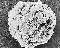 Célula cancerosa de ovario. Tomada de wwwspacedailycom