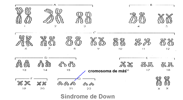 El sndrome de Down (mongolismo) se debe a la existencia de un cromosoma de ms en el par 21.
