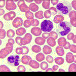 Clulas sanguneas; en el centro de la imagen se aprecia un linfocito.